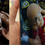 চেয়ারে বসে রইলেন নার্স, স্যালাইনের চ্যানেল খুলতে গিয়ে আড়াই মাসের শিশুর আঙুলই কেটে বাদ দিলেন ওয়ার্ড বয়!